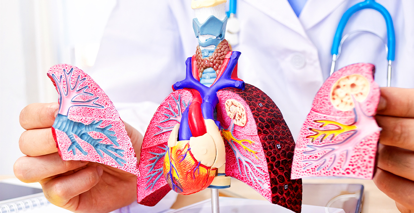 Model of lungs