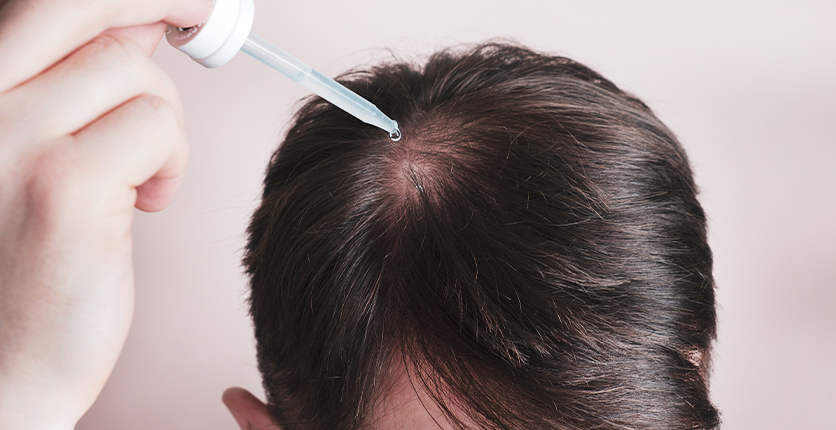 Man using a dropper to apply hair treatment